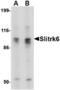 SLIT And NTRK Like Family Member 6 antibody, TA306531, Origene, Western Blot image 
