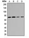 Myotubularin-related protein 2 antibody, LS-C667922, Lifespan Biosciences, Western Blot image 