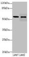 Glucagon-like peptide 1 receptor antibody, A55798-100, Epigentek, Western Blot image 