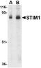 Stromal interaction molecule 1 antibody, NBP1-76789, Novus Biologicals, Western Blot image 