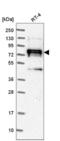 Neural Precursor Cell Expressed, Developmentally Down-Regulated 9 antibody, NBP2-55071, Novus Biologicals, Western Blot image 