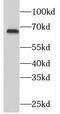 Phosphodiesterase 12 antibody, FNab06248, FineTest, Western Blot image 