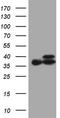 Electron transfer flavoprotein subunit alpha, mitochondrial antibody, CF808409, Origene, Western Blot image 