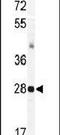 KChIP3 antibody, PA5-11665, Invitrogen Antibodies, Western Blot image 