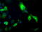 Thromboxane A Synthase 1 antibody, LS-C115356, Lifespan Biosciences, Immunofluorescence image 