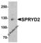 Cardiomyopathy Associated 5 antibody, 6403, ProSci, Western Blot image 