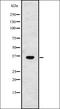 Trans-2,3-Enoyl-CoA Reductase antibody, orb335082, Biorbyt, Western Blot image 