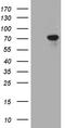 Transforming Growth Factor Beta Induced antibody, TA805390, Origene, Western Blot image 