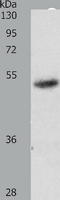 Retinoic Acid Receptor Alpha antibody, TA321250, Origene, Western Blot image 