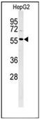 DNA polymerase lambda antibody, AP53380PU-N, Origene, Western Blot image 