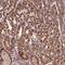 Zinc Finger Protein 513 antibody, NBP2-49009, Novus Biologicals, Immunohistochemistry paraffin image 