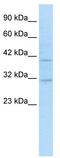 Sirtuin 6 antibody, TA330291, Origene, Western Blot image 