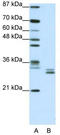Chloride intracellular channel protein 5 antibody, TA338580, Origene, Western Blot image 