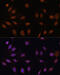 Cyclin-dependent kinase inhibitor 1B antibody, 16-728, ProSci, Immunofluorescence image 