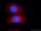 T-box transcription factor TBX2 antibody, 22346-1-AP, Proteintech Group, Immunofluorescence image 
