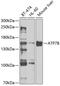 ATPase Copper Transporting Beta antibody, GTX30077, GeneTex, Western Blot image 