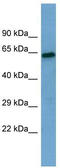 Sestrin-1 antibody, TA334538, Origene, Western Blot image 
