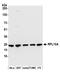 Ribosomal Protein L10a antibody, A305-061A, Bethyl Labs, Western Blot image 