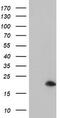 ADP Ribosylation Factor Like GTPase 5B antibody, M13605, Boster Biological Technology, Western Blot image 