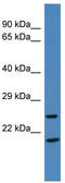 ELMO Domain Containing 1 antibody, TA344839, Origene, Western Blot image 