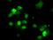 Protein Phosphatase Methylesterase 1 antibody, TA500768, Origene, Immunofluorescence image 