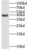 Polycomb Group Ring Finger 6 antibody, FNab06208, FineTest, Western Blot image 