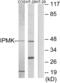 Inositol Polyphosphate Multikinase antibody, abx013707, Abbexa, Western Blot image 