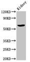 Acyl-CoA Binding Domain Containing 3 antibody, CSB-PA863972LA01HU, Cusabio, Western Blot image 