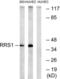 Ribosome Biogenesis Regulator 1 Homolog antibody, LS-C120341, Lifespan Biosciences, Western Blot image 