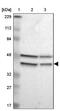 G patch domain and ankyrin repeats-containing protein 1 antibody, NBP1-90165, Novus Biologicals, Western Blot image 