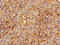 Annexin A2 antibody, A56863-100, Epigentek, Immunohistochemistry paraffin image 