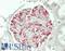 Short palate, lung and nasal epithelium carcinoma-associated protein 2 antibody, LS-B14333, Lifespan Biosciences, Immunohistochemistry paraffin image 