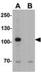 Ubiquitin Specific Peptidase 25 antibody, GTX17216, GeneTex, Western Blot image 