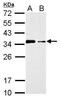 Cytokine-inducible SH2-containing protein antibody, PA5-27128, Invitrogen Antibodies, Western Blot image 
