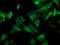 Mitotic checkpoint serine/threonine-protein kinase BUB1 beta antibody, LS-C114705, Lifespan Biosciences, Immunofluorescence image 