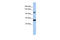 Zinc Finger And SCAN Domain Containing 20 antibody, 25-145, ProSci, Enzyme Linked Immunosorbent Assay image 