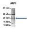 Catenin Delta 1 antibody, orb382649, Biorbyt, Immunoprecipitation image 