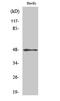 Keratin 17 antibody, STJ92630, St John