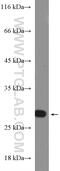RAB27A, Member RAS Oncogene Family antibody, 16868-1-AP, Proteintech Group, Western Blot image 