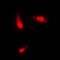 Keratin 8 antibody, LS-B16077, Lifespan Biosciences, Immunofluorescence image 