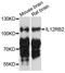 Interleukin 12 Receptor Subunit Beta 2 antibody, STJ112386, St John