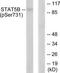 Signal Transducer And Activator Of Transcription 5B antibody, TA311626, Origene, Western Blot image 