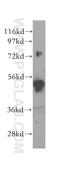 Sorting Nexin 4 antibody, 11506-1-AP, Proteintech Group, Western Blot image 
