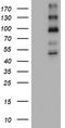 ALK Receptor Tyrosine Kinase antibody, TA801612AM, Origene, Western Blot image 