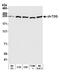 Cytoskeleton-associated protein 5 antibody, A301-971A, Bethyl Labs, Western Blot image 