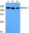 Dedicator Of Cytokinesis 11 antibody, A12259, Boster Biological Technology, Western Blot image 