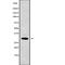 Carcinoembryonic antigen-related cell adhesion molecule 7 antibody, abx149191, Abbexa, Western Blot image 