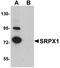 Sushi Repeat Containing Protein X-Linked antibody, orb94338, Biorbyt, Western Blot image 