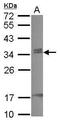 Chromobox protein homolog 7 antibody, PA5-30471, Invitrogen Antibodies, Western Blot image 