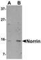 Norrin Cystine Knot Growth Factor NDP antibody, NBP1-77014, Novus Biologicals, Western Blot image 